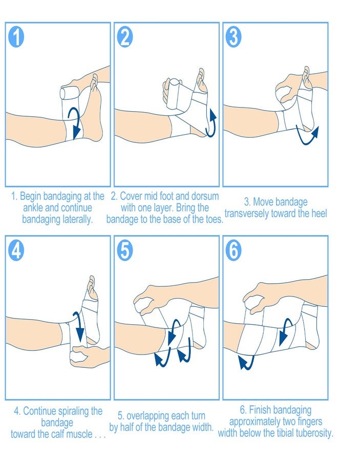 Threlaco ضمادات ثريلاكو لعلاج الوذمة اللمفاوية، 4 قطع، للساقين، ضمادات حشو، ضمادات طبية غير لاصقة من الفوم، ضمادات حشو للوذمة اللمفاوية تحت الضمادات الرغوية لتوزيع الضغط والوذمة الرياضية - Image 4